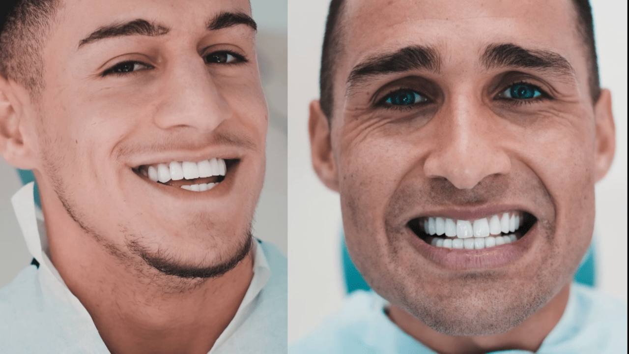 How your smile may affects us