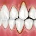 Oral Health -