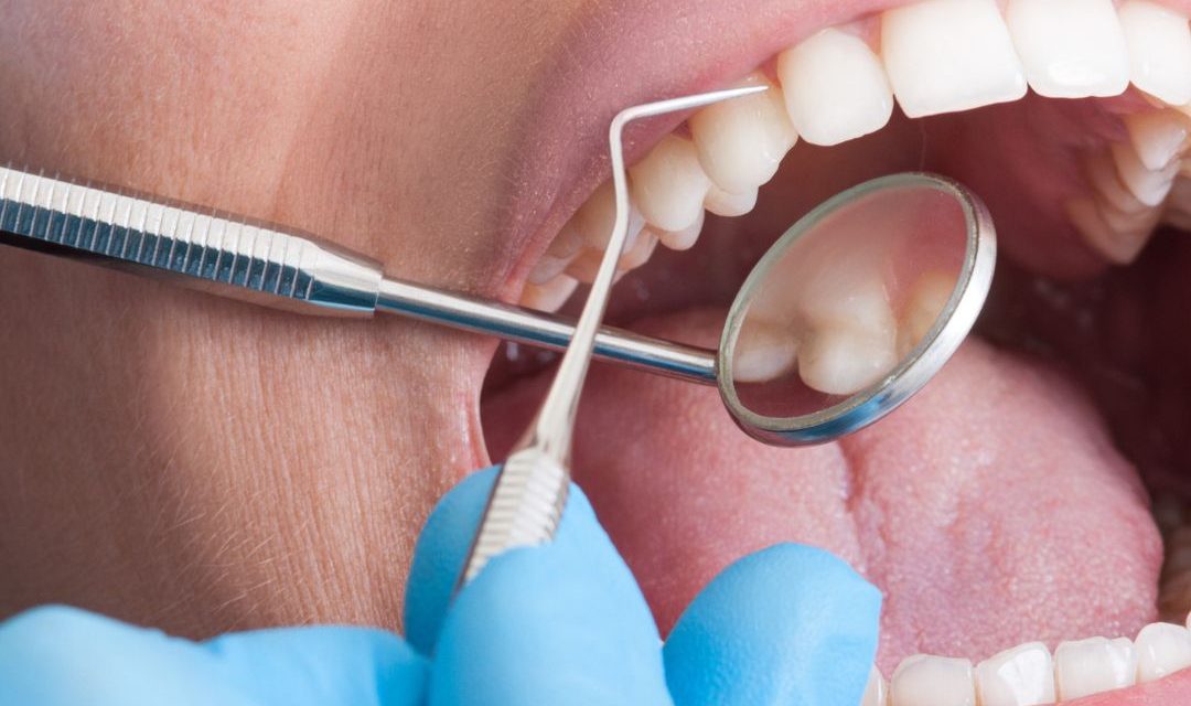 Alanya Dental Treatment