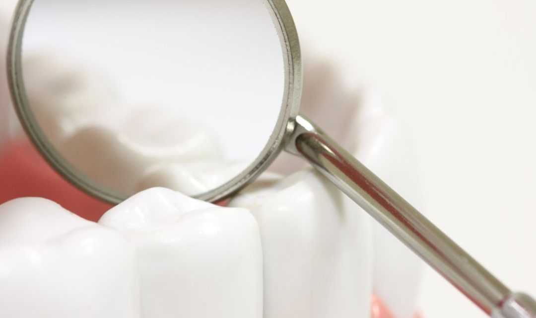 Dentistry in Alanya: Expert Dental Care at Ova Dent