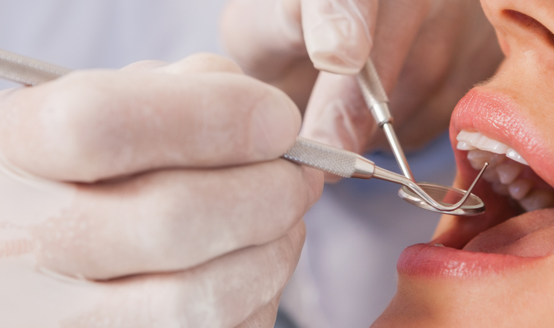 Alanya General Dentistry Services at OVA Dent