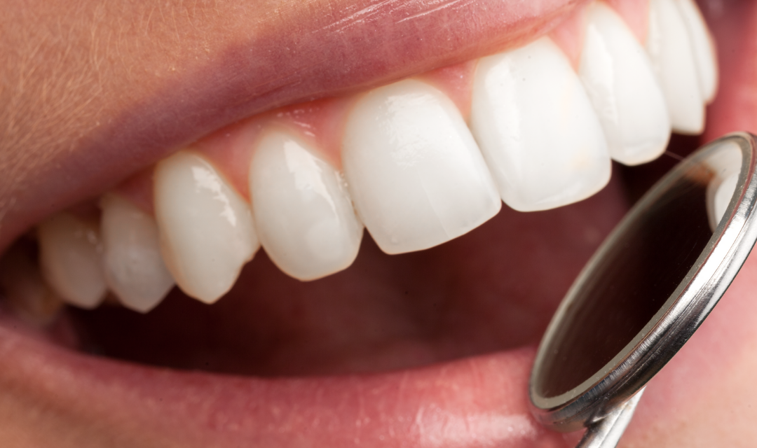 Alanya Dental Surgery at OVA Dent: Safe and Professional Care