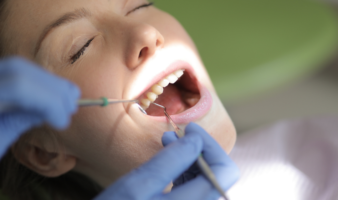 Alanya Teeth Whitening Services at OVA Dent