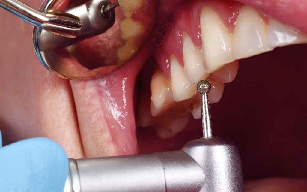 Alanya orthodontics — Ova Dent