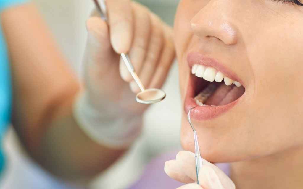 Alanya dental crowns — Ova Dent